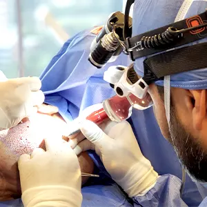 Img-expertos-en-microimplante-capilar-Paso_a_Paso-1