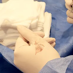 Img-expertos-en-microimplante-capilar-Paso_a_Paso-3