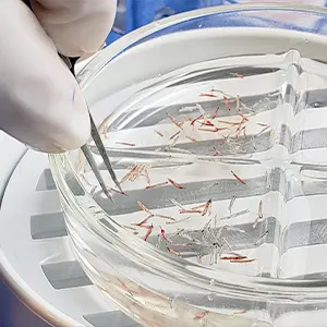 Img-expertos-en-microimplante-capilar-Paso_a_Paso-4