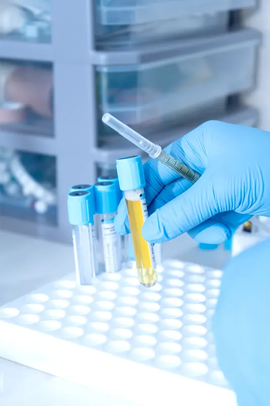 Img-MicroImplante_Capilar-Tratamiento-Individual-Plasma